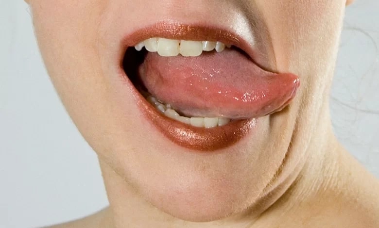 Pushing the Boundaries of Tongue Trick Innovation